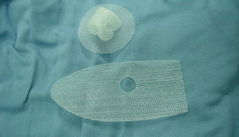 Hernia mesh 1