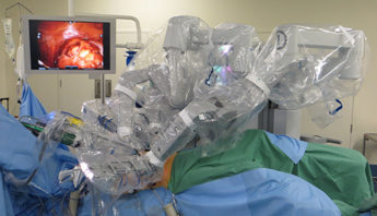robotic surgery